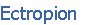 Ectropion